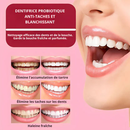 Dentifrice Probiotique Yayashi SP-6 – Le secret d’un sourire éclatant