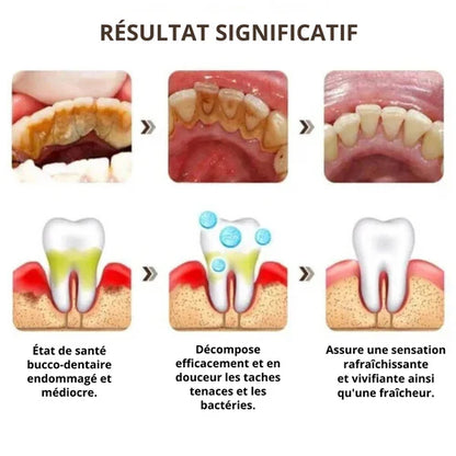 Dentifrice Probiotique Yayashi SP-6 – Le secret d’un sourire éclatant